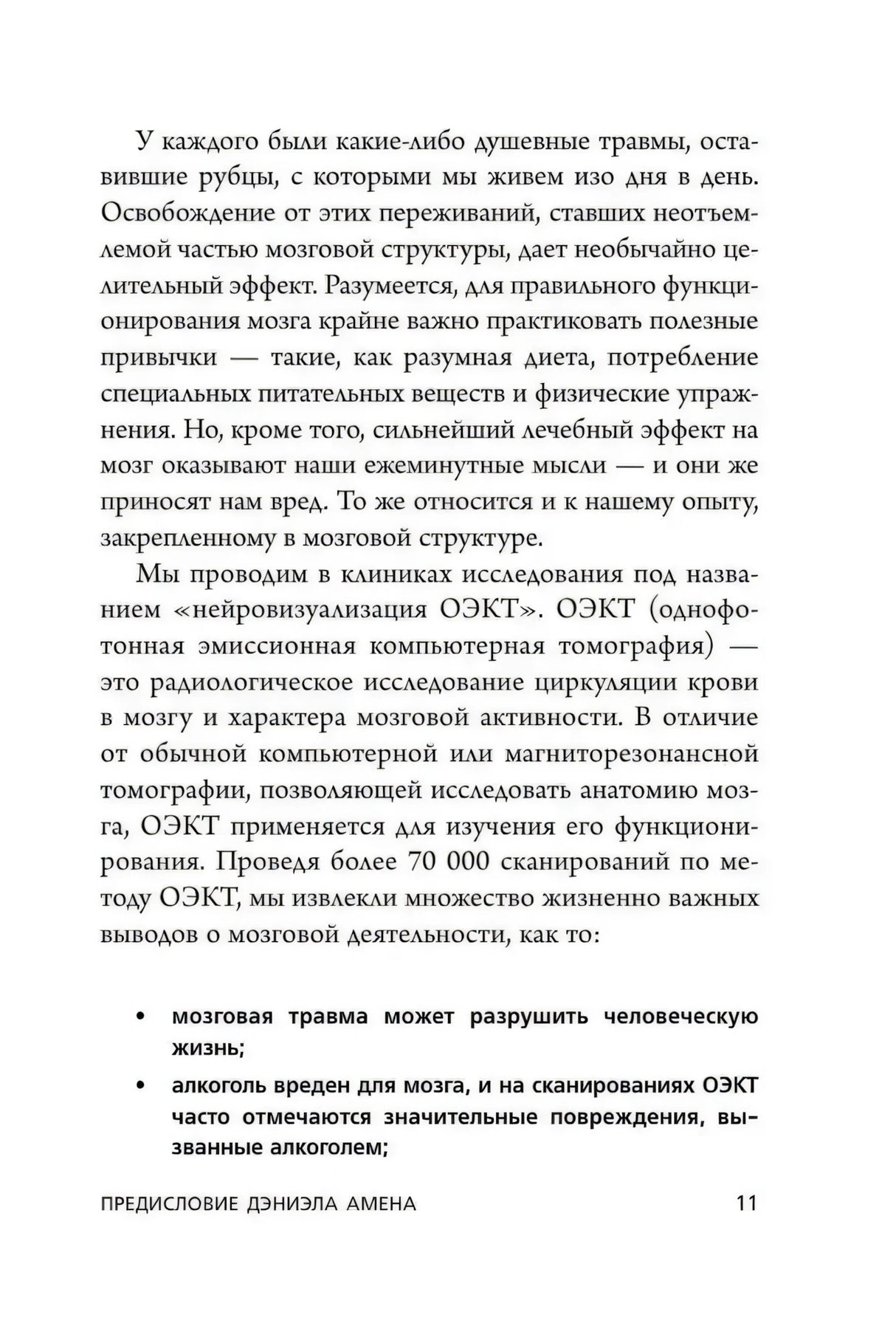 Страница о нейровизуализации ОЭКТ