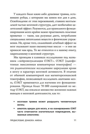 Страница о нейровизуализации ОЭКТ